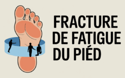 illustration pied fracture fatigue et bandage